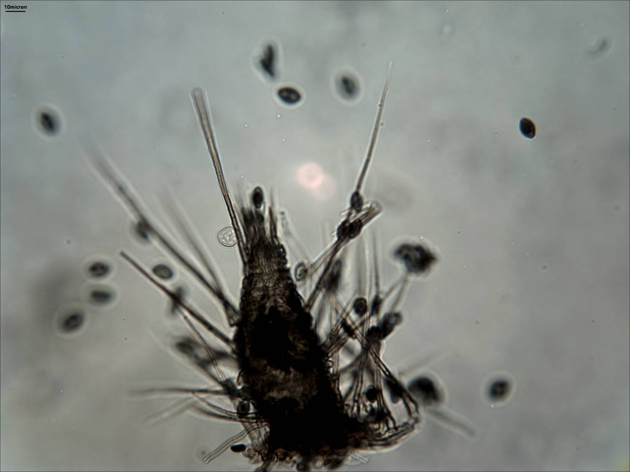 Представитель Семейства Chaetomiaceae
